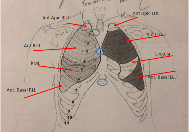 chest auscultation points