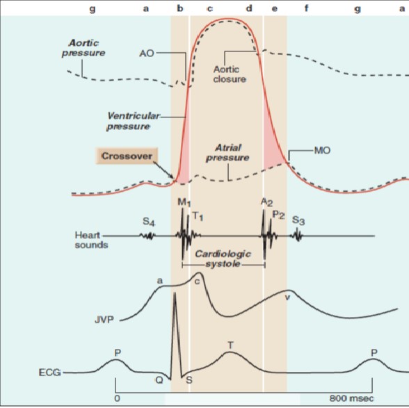 Heart Auscultation and Murmurs – Physical Therapy Reviewer